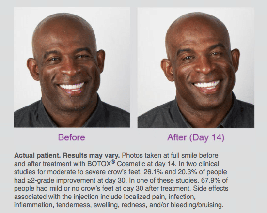 Deion Sanders Before and After