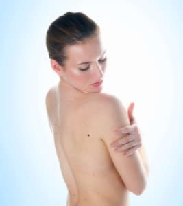 laser skin treatment san antonio tx | Dr. Vivian Bucay