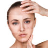 Facials for Acne Acne Cure San Antonio, TX