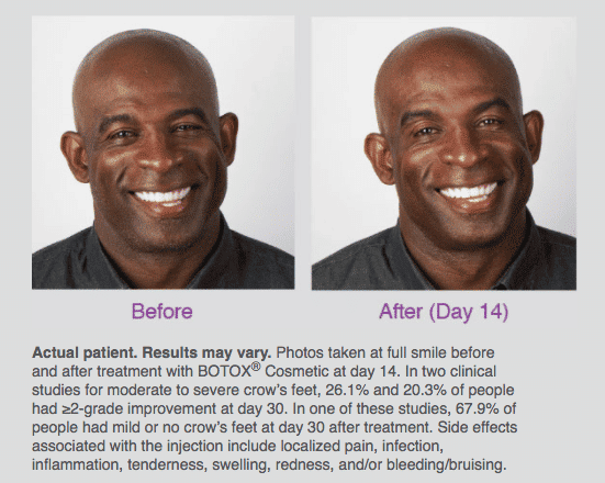 Deion Sanders Before and After 1