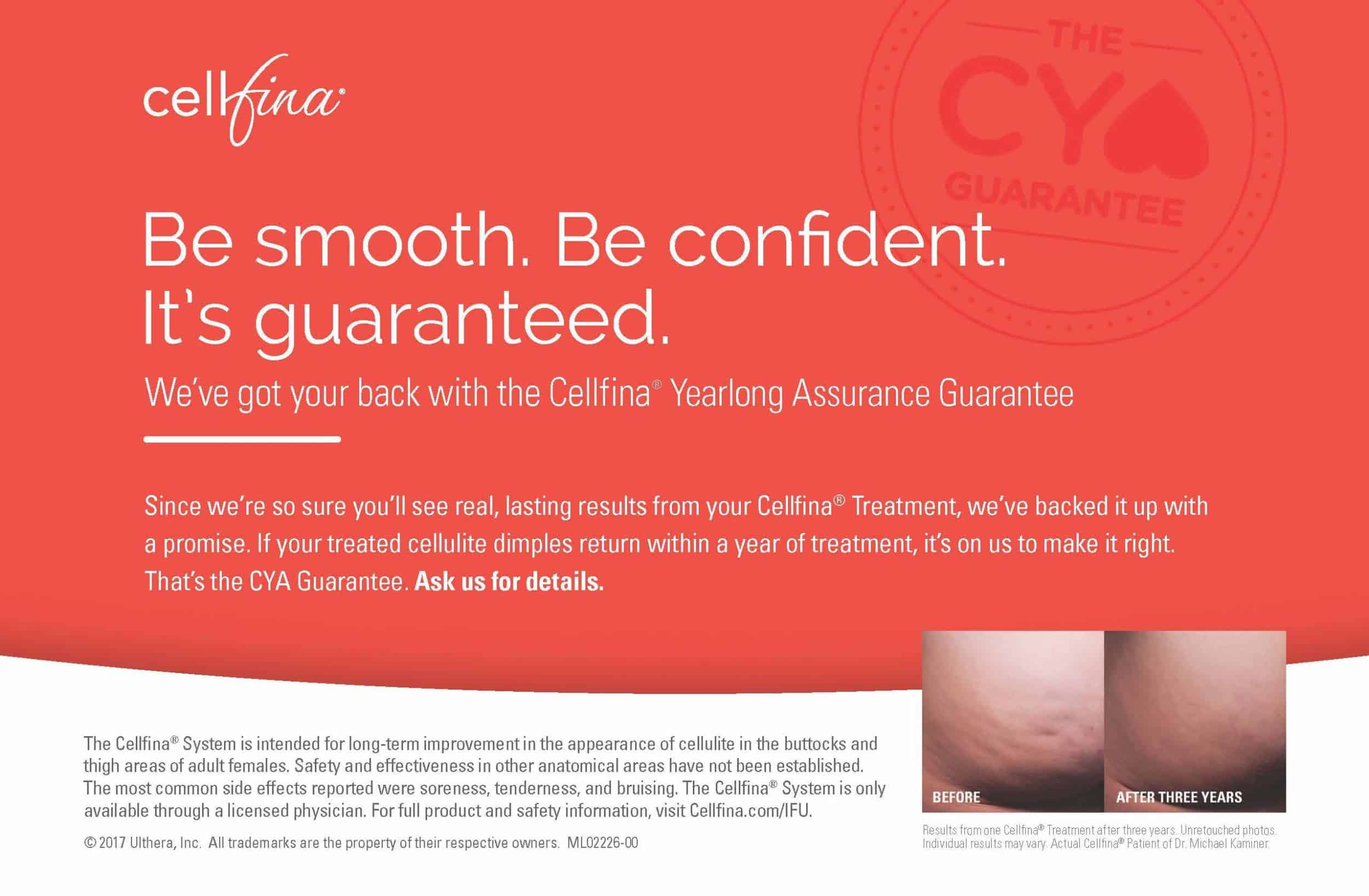 ML022260 00 Cellfina Yearlong Assurance Guarantee Counter Card 10 25 17