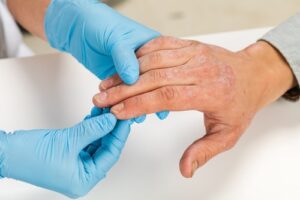 A dermatologist wearing gloves examines the skin of a patient