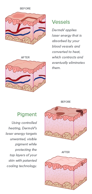 DERMAV PIC