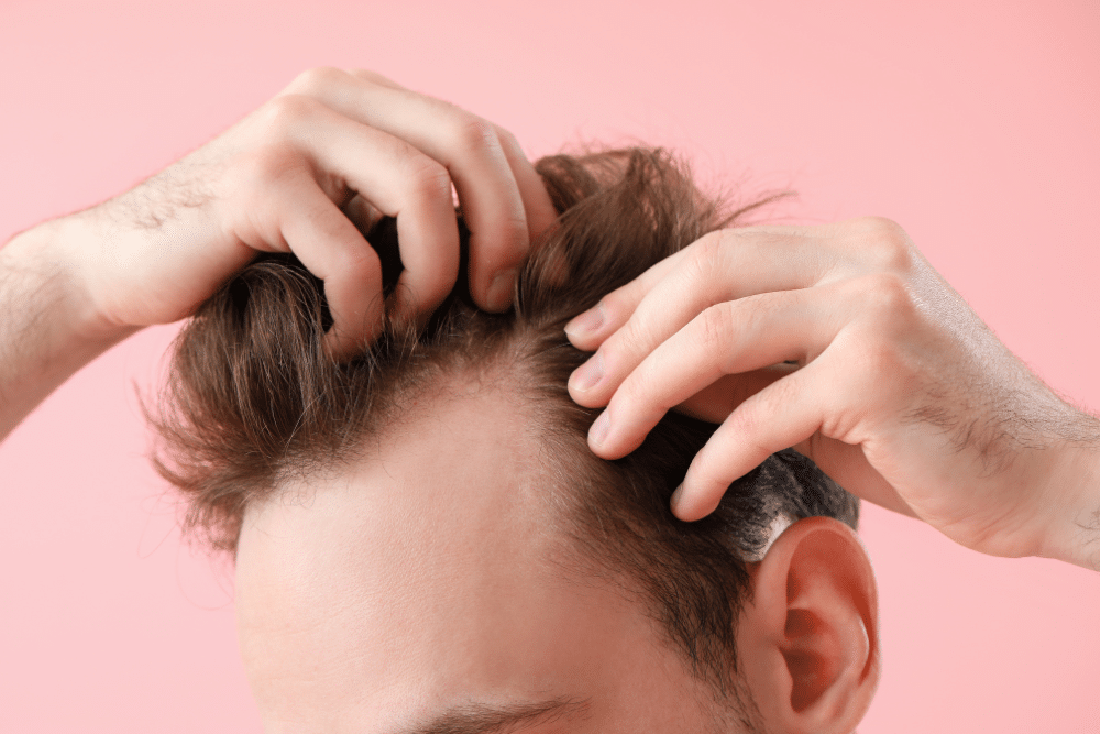 hair loss treatment