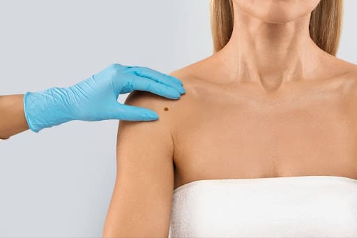 Learn more about how to identify signs of melanoma, and be sure to schedule your skin cancer screening in San Antonio today.