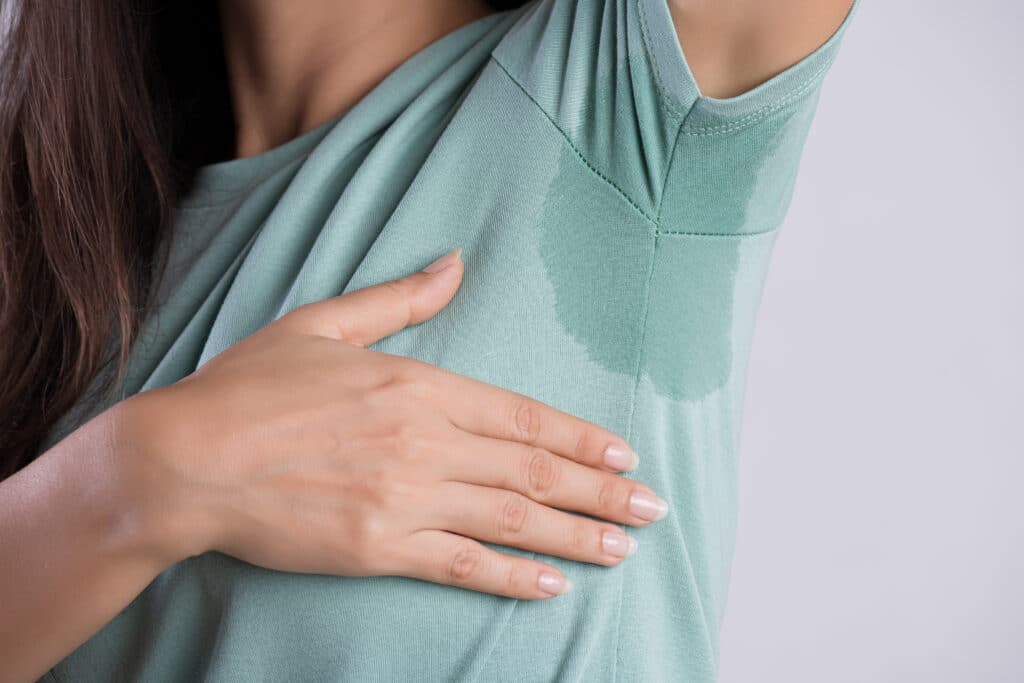 Close up,Asian,Woman,With,Hyperhidrosis,Sweating.,Young,Asia,Woman,With