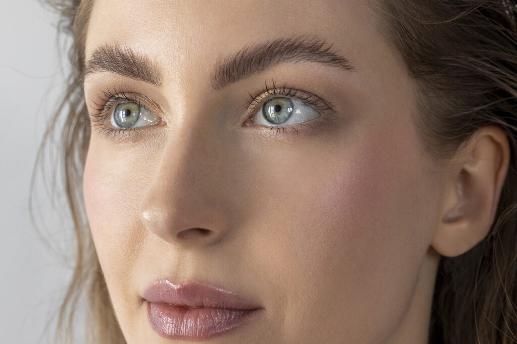Woman after non-surgical rhinoplasty treatment.